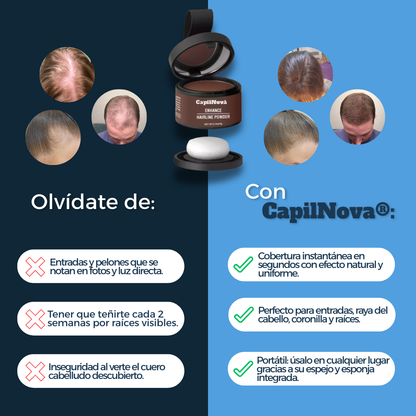 CapilNova – Olvídate de la inseguridad por tu cabello