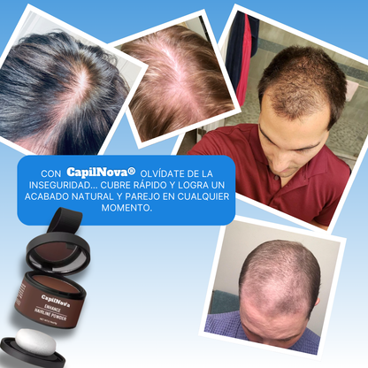 CapilNova – Olvídate de la inseguridad por tu cabello