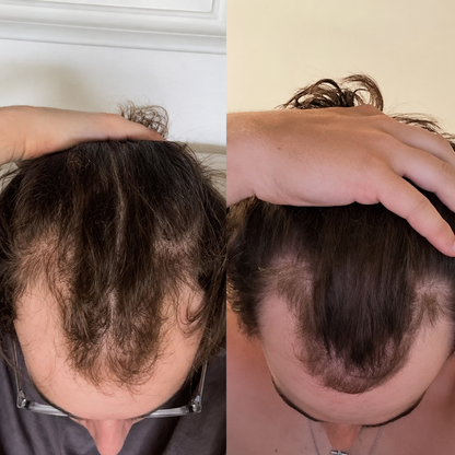 Renova Men™ - Sistema masculino de cuidado capilar